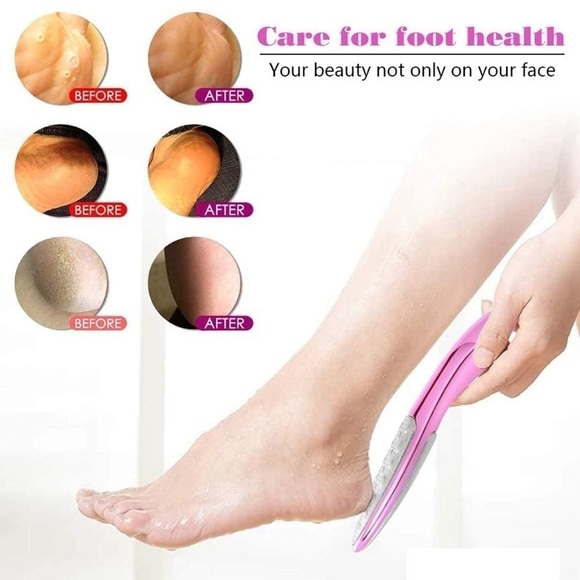 FERYES Foot File Callus Remover - Picture 4 of 11